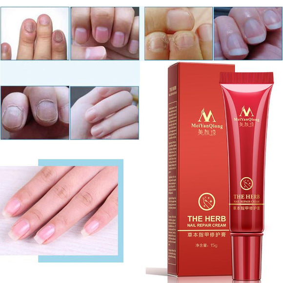 Nail Treatment Cream - Babybyrds