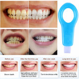 Pro Nano Teeth Whitening Kit - Babybyrds